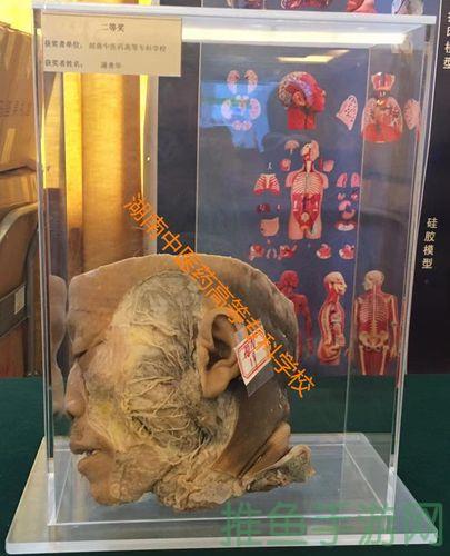 【必读】标本零中文版下载，教你轻松获取优质的医学资源-52KMS